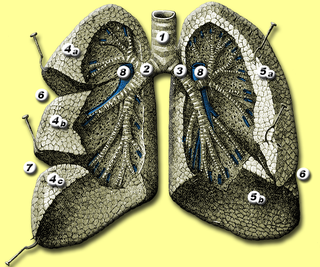 Illustration for article titled Un paciente con insuficiencia cardíaca tosió este insólito coágulo de sangre perfecto con forma de pasaje pulmonar